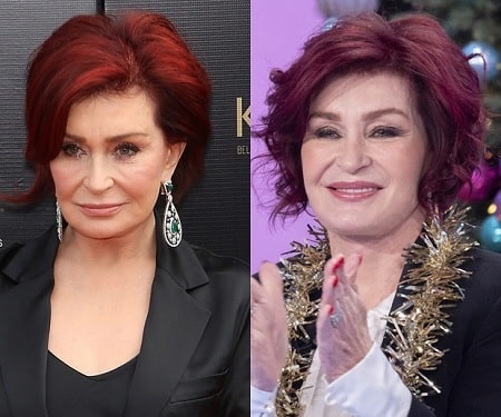 A picture of Sharon Osbourne before (left) and after (right) plastic surgeries.